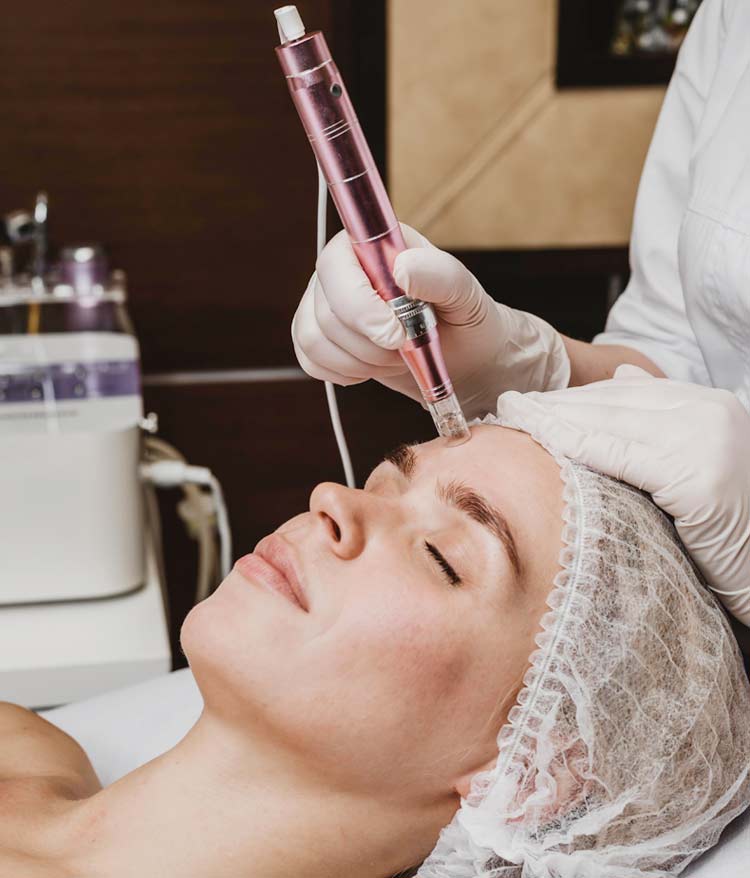 Microdermabrasion in München